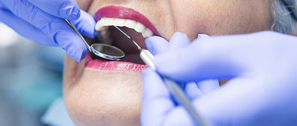 Best Emergency Treatment for Dental Infections or Abscesses in Springboro, OH